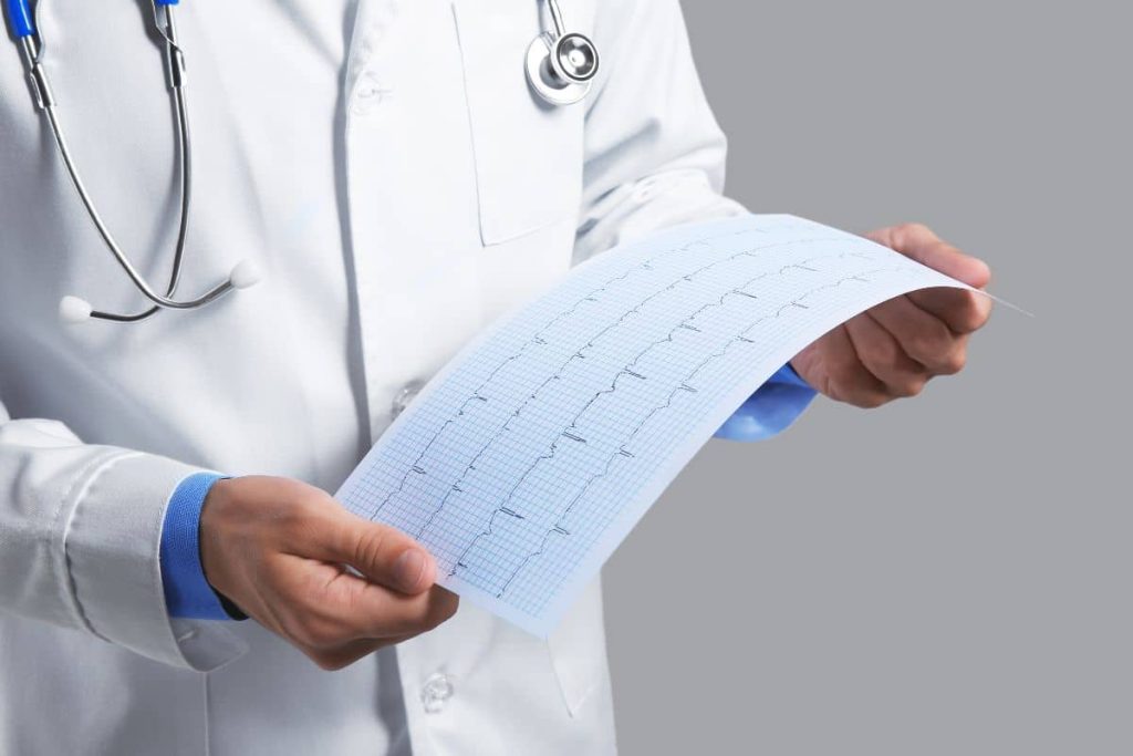 Resultados de los estudios cardiologia