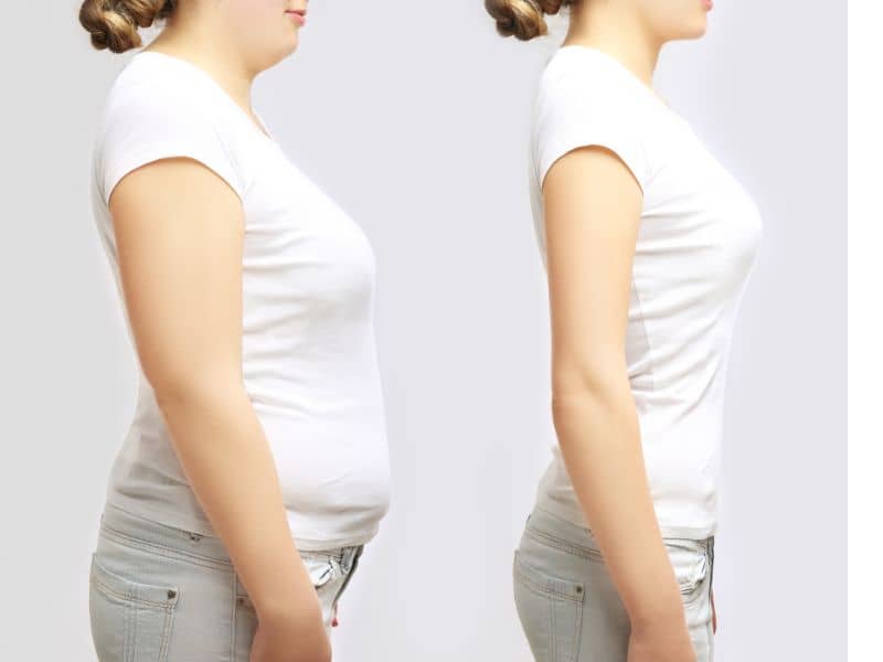 Cuidados tras colocar balon gastrico ingerible