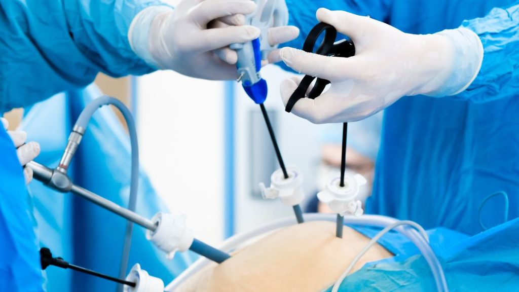 postoperatorio reparación endoscópica preaponeurótica