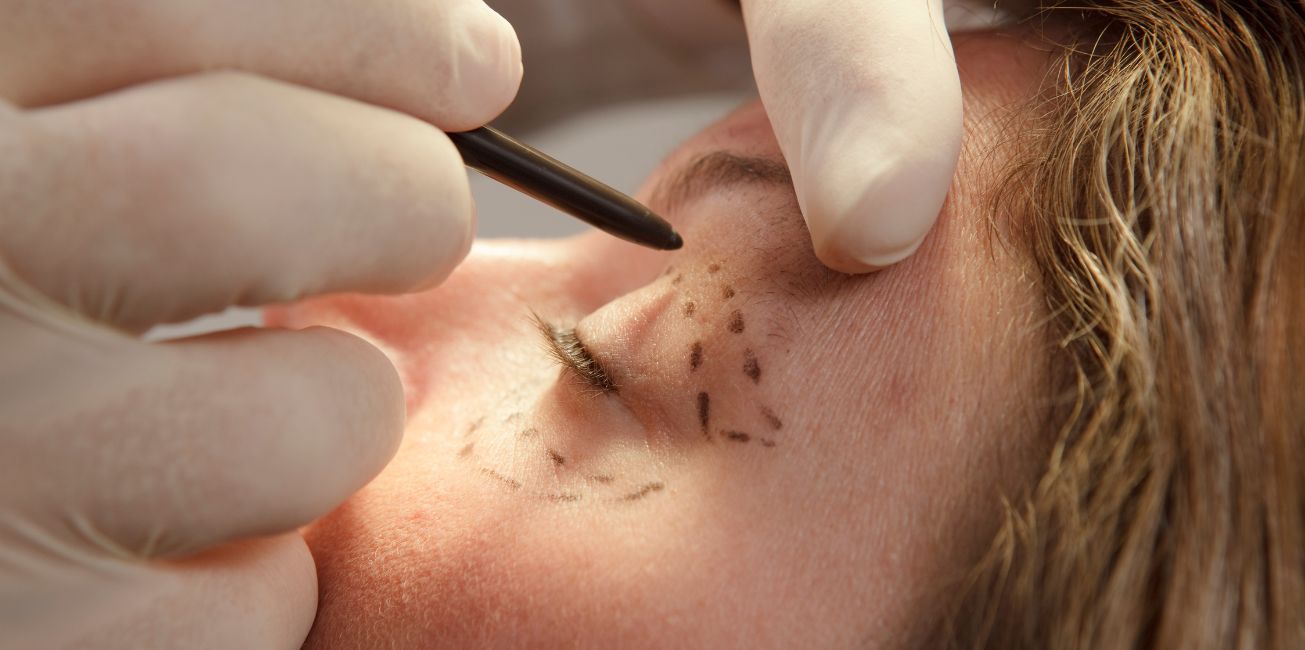 cirugía estética y reconstructiva de ojos