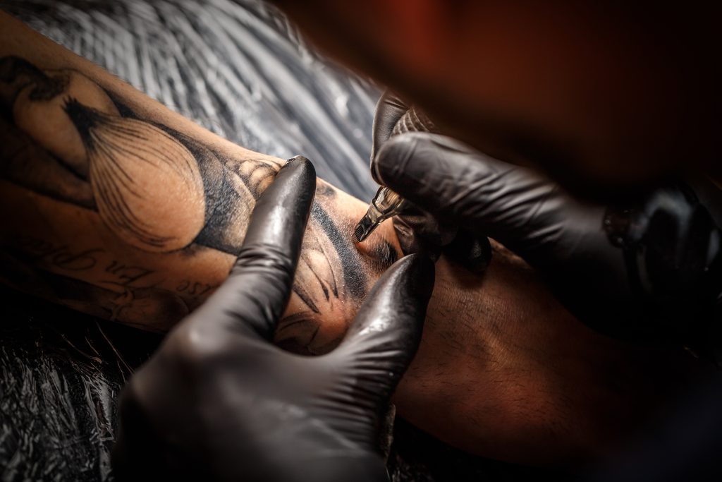 quitar tatuaje